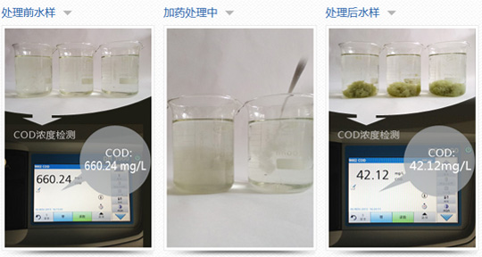 拔了八顆牙齒 矯牙后大變樣！